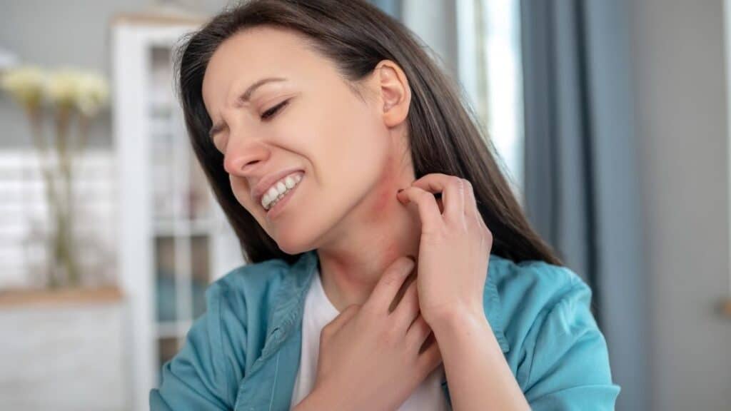 What Are the Symptoms of an Avocado Allergy