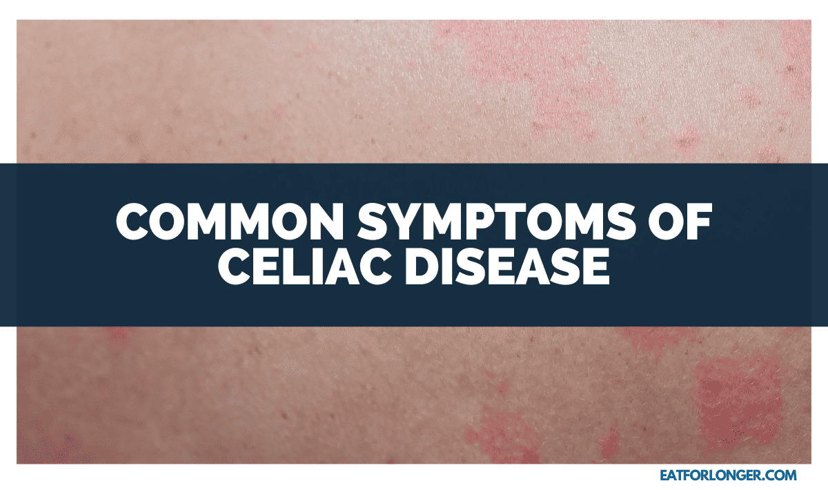 Common Symptoms of Celiac Disease